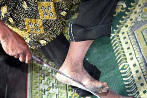 Dị nhân Quảng Bình mút dao nung đỏ như... mút kem - 3