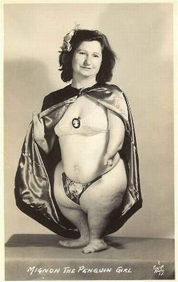 Sốc với bộ ảnh người xưa kỳ lạ, Phi thường - kỳ quặc, chuyen la, chuyen la the gioi, nhung nguoi co hinh dang ky la, ngoi co xua, nguoi xua, nguoi ky la, anh la, hinh xam, dong dinh vao mui, tin tuc